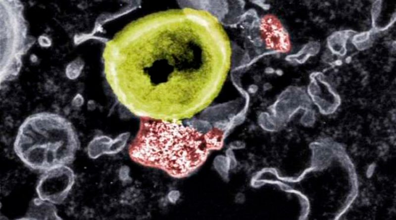 Nanopartículas para matar bacterias farmacorresistentes
