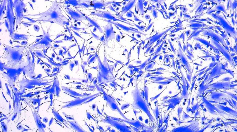 Científicas panameñas ganan concurso internacional de fotografía de células madre