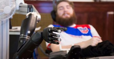 Como si fuera tu propia mano: el brazo robótico con emociones