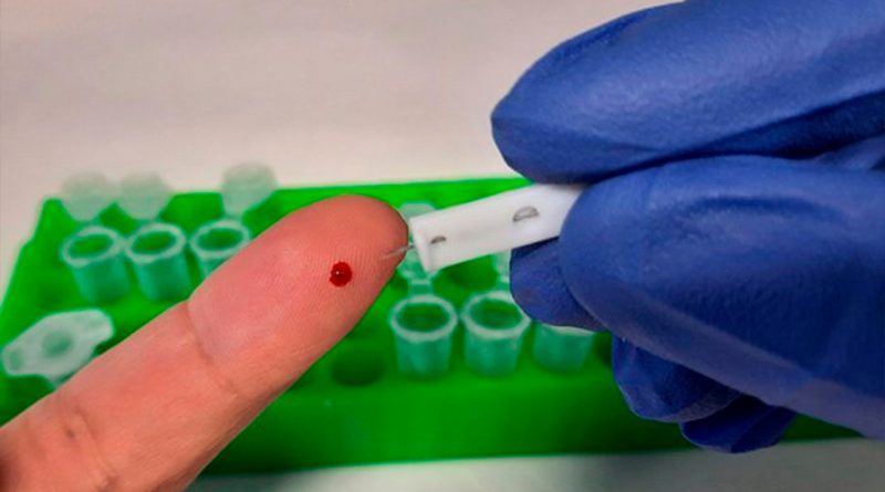 Nueva prueba logra detectar los anticuerpos “invisibles” contra el coronavirus