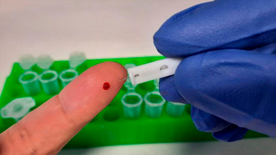 Nueva prueba logra detectar los anticuerpos “invisibles” contra el coronavirus