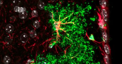 Cómo son las células “gorditas” del cerebro que podrían ayudar a repararlo en casos de enfermedad