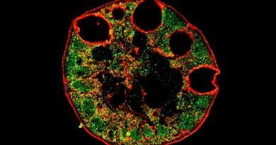 Células anómalas que se vuelven cáncer de esófago surgen en el estómago