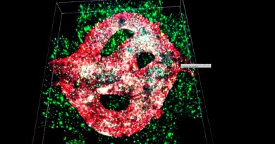 Por primera vez científicos imprimen en 3D un tumor cancerígeno cerebral