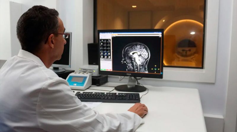 Investigadores españoles descubren cómo detectar el Alzheimer temprano en la saliva