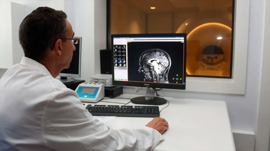 Investigadores españoles descubren cómo detectar el Alzheimer temprano en la saliva