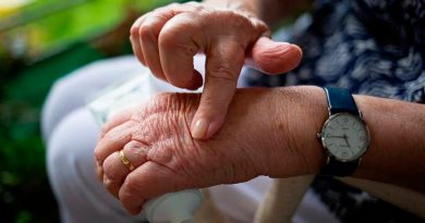 Científicos norteamericanos desarrollan potente vacuna contra la artritis de forma accidental