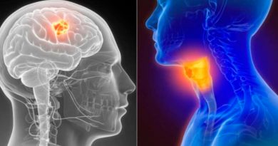 Nuevo tratamiento destruye tumores del cáncer de cabeza y cuello, según estudio