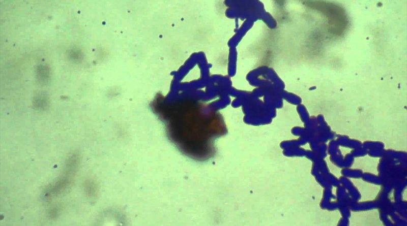 Leptospirillum: una bacteria que come metal y puede devorar un clavo en tres días