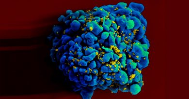 Identifican un segundo paciente con VIH no tratado que parece haberse deshecho del virus