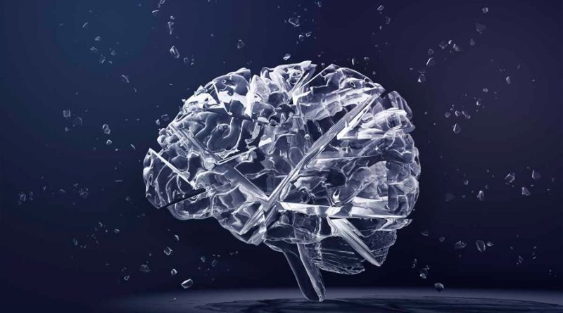 Implante cerebral traduce en texto los pensamientos de un hombre paralizado con 94 % de precisión