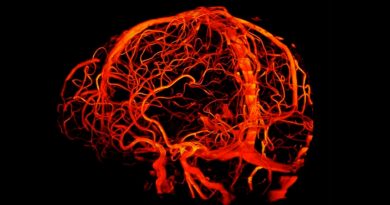 Investigadores usan células madre teledirgidas para tratar enfermedades cerebrales sin cirugía