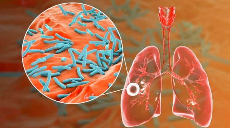 UNAM desarrolla un péptido que podría actuar contra la tuberculosis