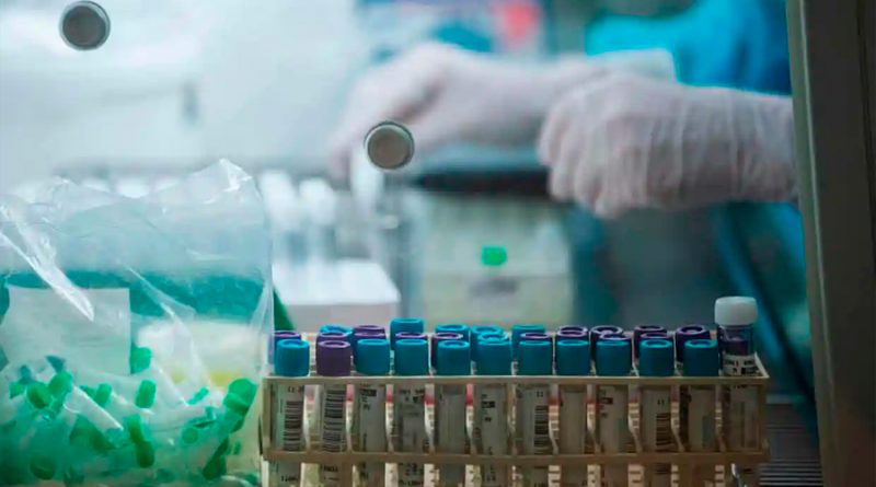 Los científicos descubren una versión ‘sigilosa’ de ómicron que la prueba PCR no puede identificar