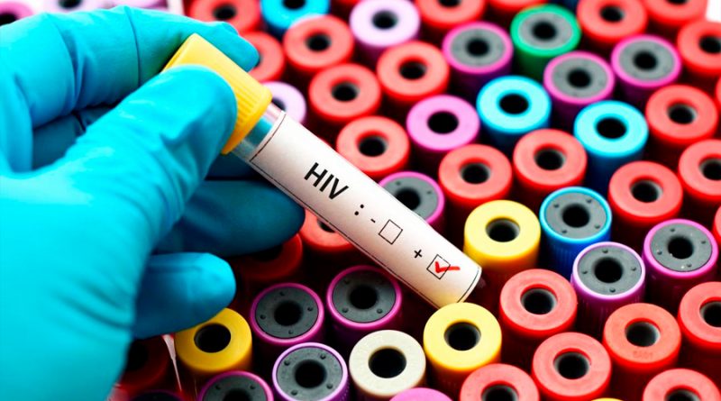 Iniciativas para acelerar la larga y difícil búsqueda de una vacuna contra el VIH