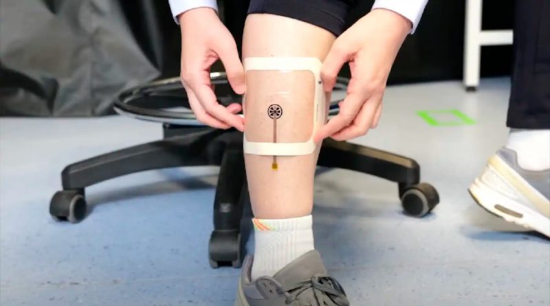 VeCare, la venda inteligente que monitoriza heridas crónicas en tiempo real desde una aplicación