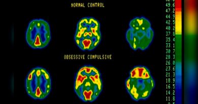 Detectan en tiempo real señales cerebrales asociadas al TOC