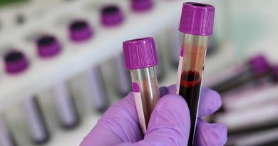 Crean el primer test de sangre que identifica si una persona tiene cáncer y si se ha propagado
