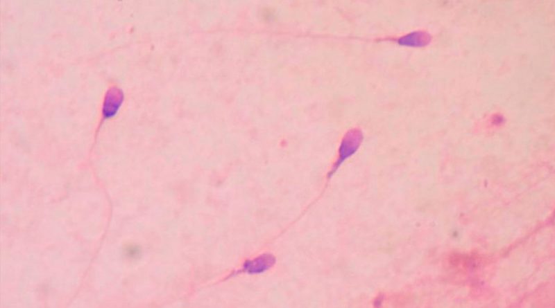 Calentar los testículos con nanopartículas podría funcionar como anticonceptivo: expertos
