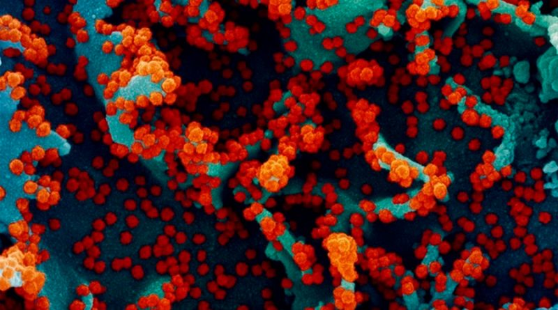 Un estudio encuentra un posible 'talón de Aquiles' en los virus respiratorios