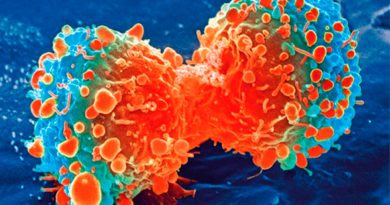 Hallan el gen clave en el desarrollo de cáncer linfático que abre nuevos posibles tratamientos