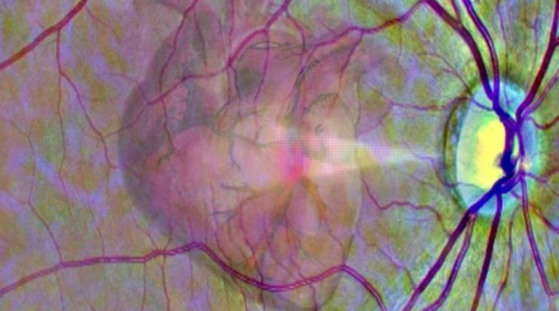 Un escáner de retina ve si puedes tener un infarto en el próximo año