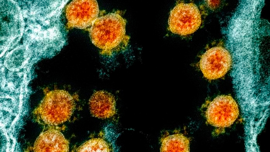 Una nueva herramienta saca a la luz 130,000 virus desconocidos