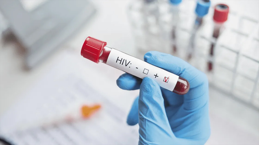 Investigadores de la Universidad de Oxford descubren una nueva variante de VIH más virulenta y transmisible