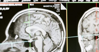 Científicos crean un sistema usando escáneres cerebrales para medir niveles de atención