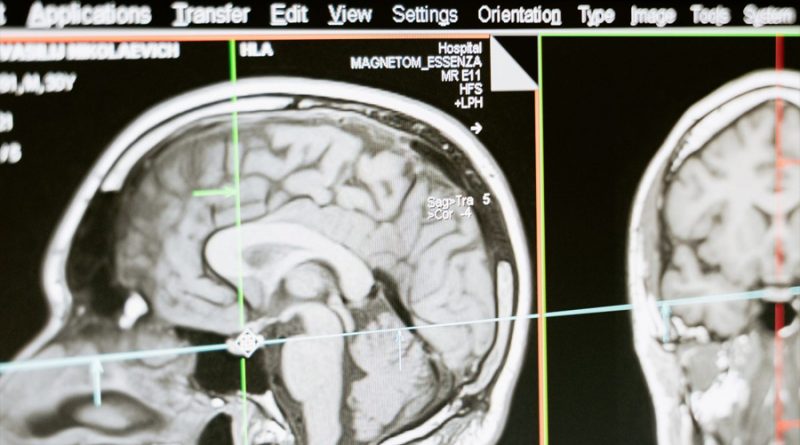 Científicos crean un sistema usando escáneres cerebrales para medir niveles de atención