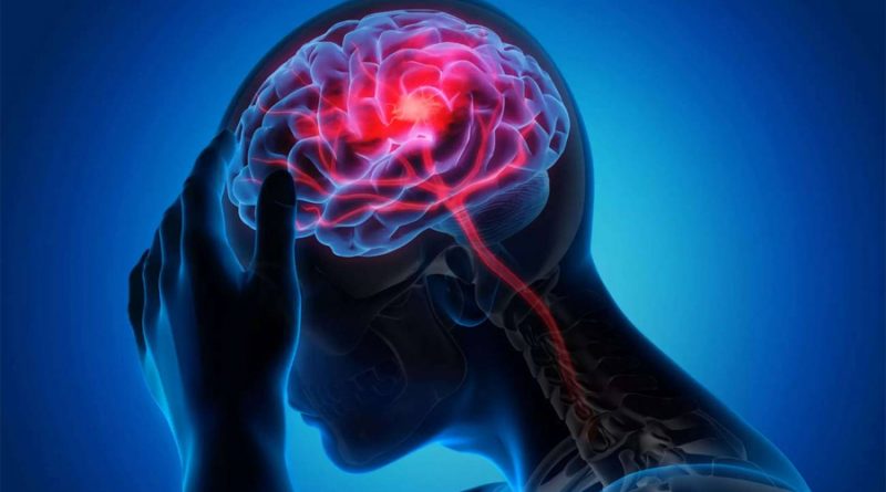 El ictus cerebral mata las neuronas mediante ondas eléctricas letales