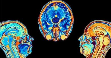 Un estudio muestra que el cerebro se encoge tras una infección de covid-19, aunque esta sea leve
