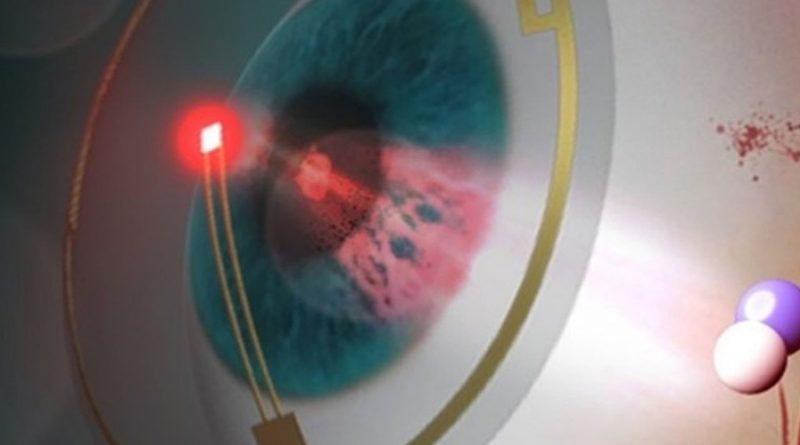 Unas lentes de contacto inteligentes previenen la retinopatía diabética