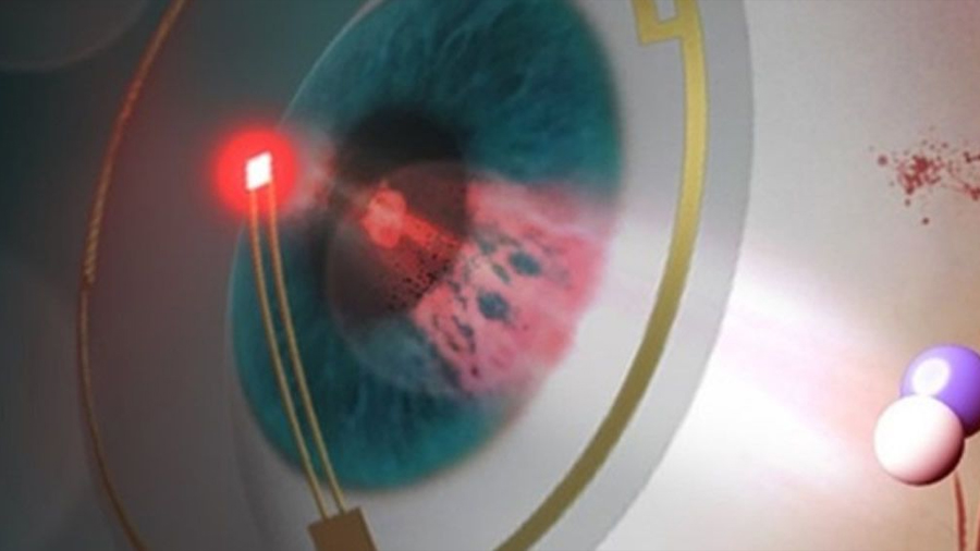 Unas lentes de contacto inteligentes previenen la retinopatía diabética