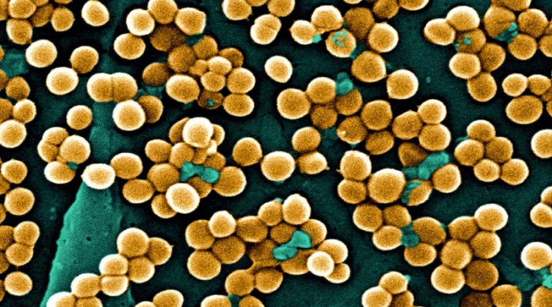 Describen cómo se propaga el estafilococo dorado, una superbacteria letal