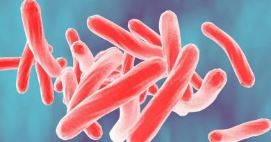 Las muertes por tuberculosis se disparan en el mundo por efecto del covid-19