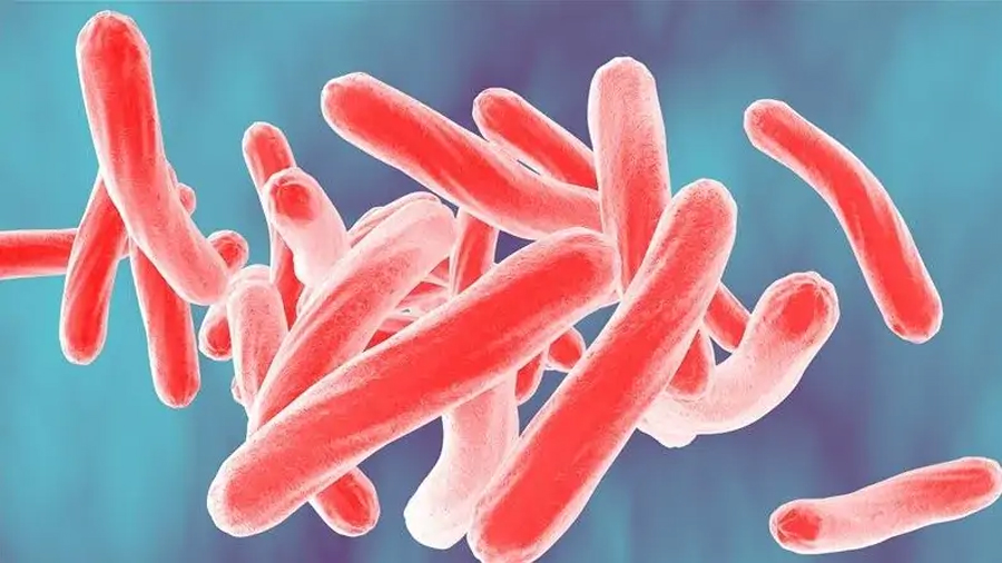 Las muertes por tuberculosis se disparan en el mundo por efecto del covid-19