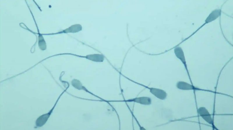 Científicos crean chip para separar los espermatozoides ‘buenos’