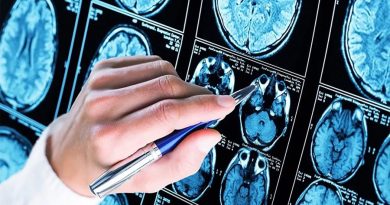 Gran avance: identificados hasta 75 factores de riesgo genético asociados al Alzheimer