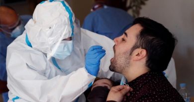Un examen de saliva podría predecir si un infectado de covid-19 terminará grave