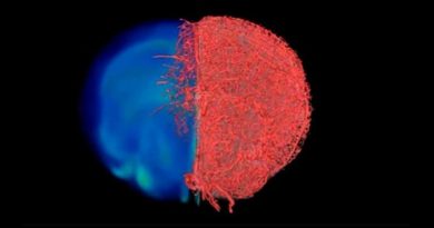 Nueva técnica de imagen muestra los vasos sanguíneos como nunca antes