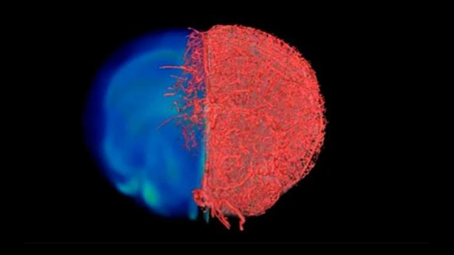 Nueva técnica de imagen muestra los vasos sanguíneos como nunca antes