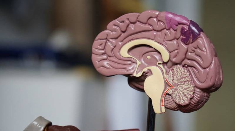 Nuevo implante cerebral parece revertir los síntomas del Párkinson