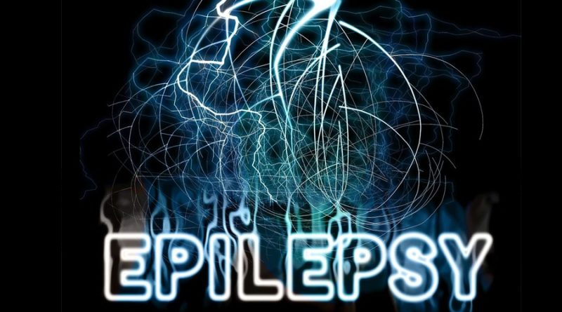 Un algoritmo detecta automáticamente focos epilépticos en el cerebro