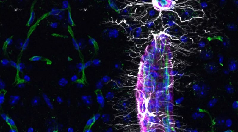 Ciéntificos descubren una molécula que permite rejuvenecer el cerebro y recuperar memoria en ratones