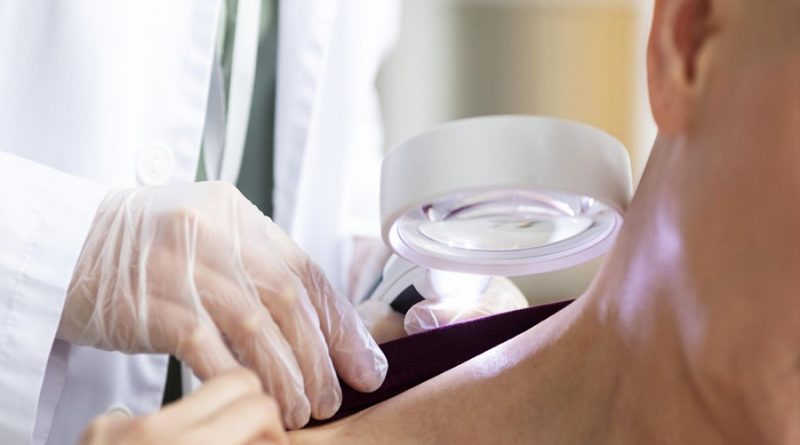 Un dispositivo portátil podría evitar las biopsias e identificar sin dolor el cáncer de piel
