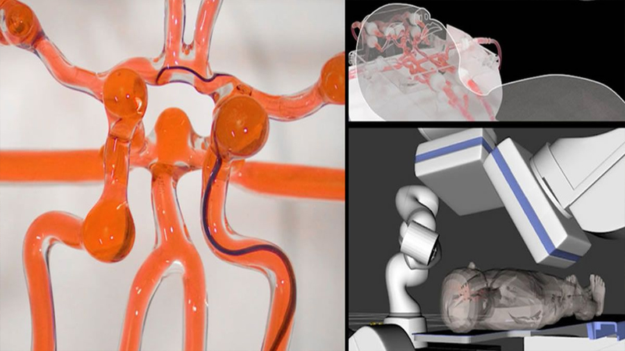 Nuevo robot para tratar de forma remota los accidentes cerebrovasculares