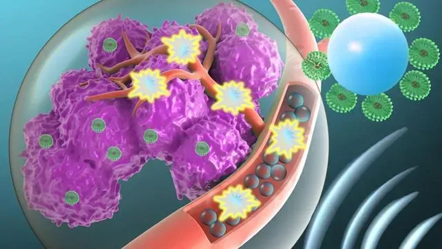 Desarrollan unas microburbujas para transportar fármacos contra el cáncer