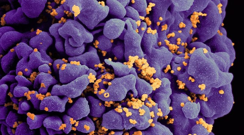 Una tecnología ofrece tratamiento para la infección por VIH a través de una sola inyección