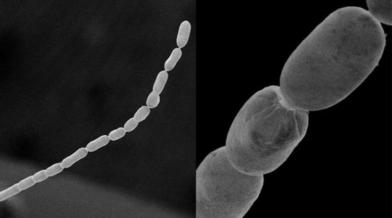 Descubren la bacteria más grande del mundo: mide hasta 2 centímetros
